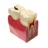 Różne modele zębów dentystycznych są używane do nauczania i materiału dentystycznego szpitala 6
